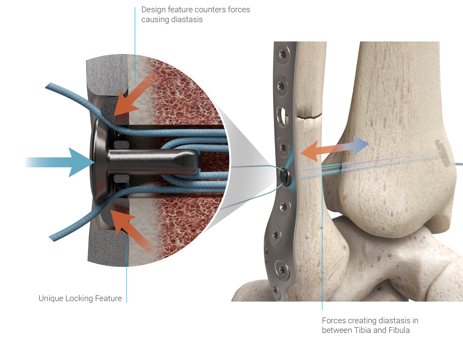 https://dunamismedical.com/wp-content/uploads/Cross-Section-copy-1.png