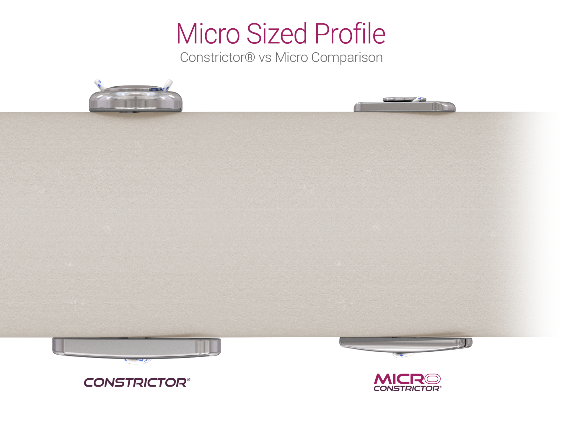 Micro-profile-comparison - Dunamis Medical